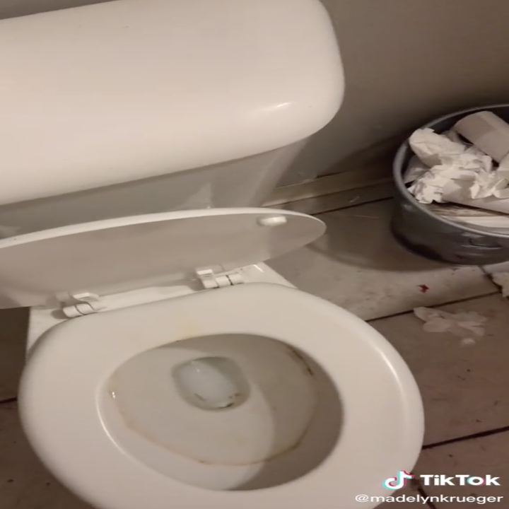 Image of a dirty toilet with overflowing trash.