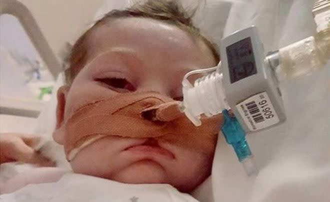 Earlier this month, Connie Yates shared an image of Charlie with his eyes open that read 