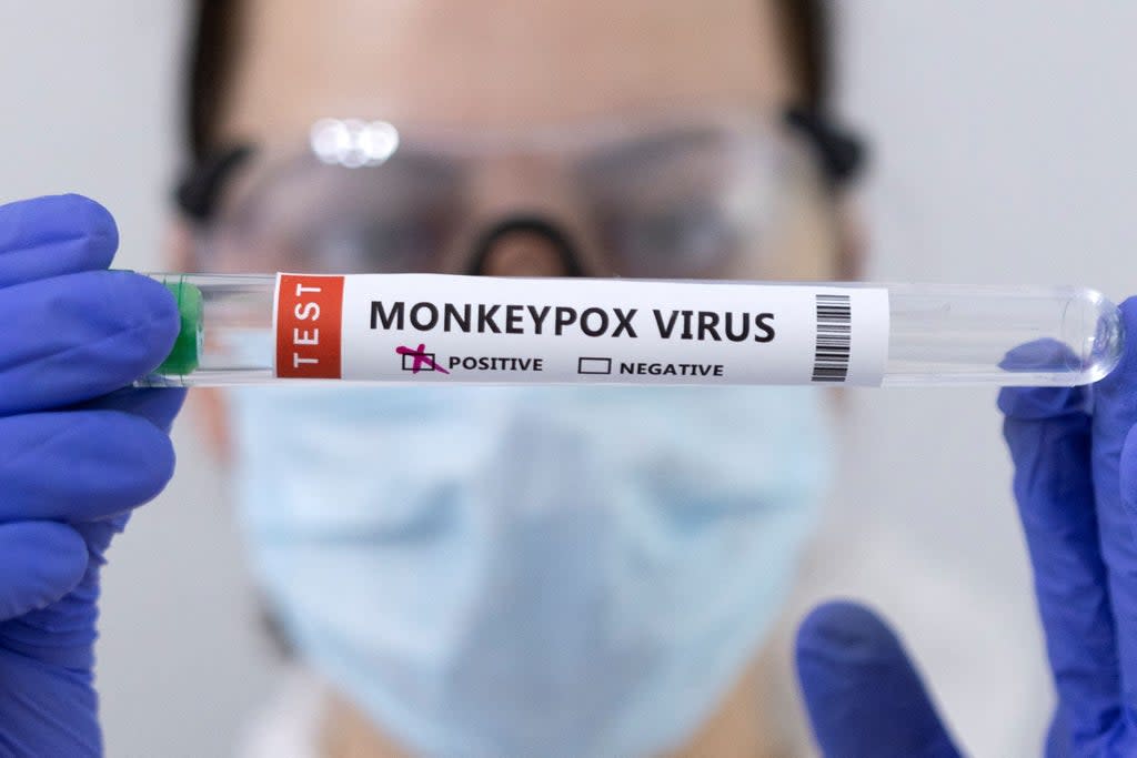 Test tubes labelled ‘Monkeypox virus positive’ are seen in this illustration  (Reuters )