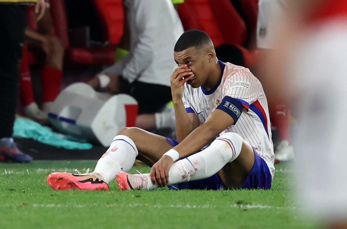 Het gaat niet goed met Mbappé na een neusblessure