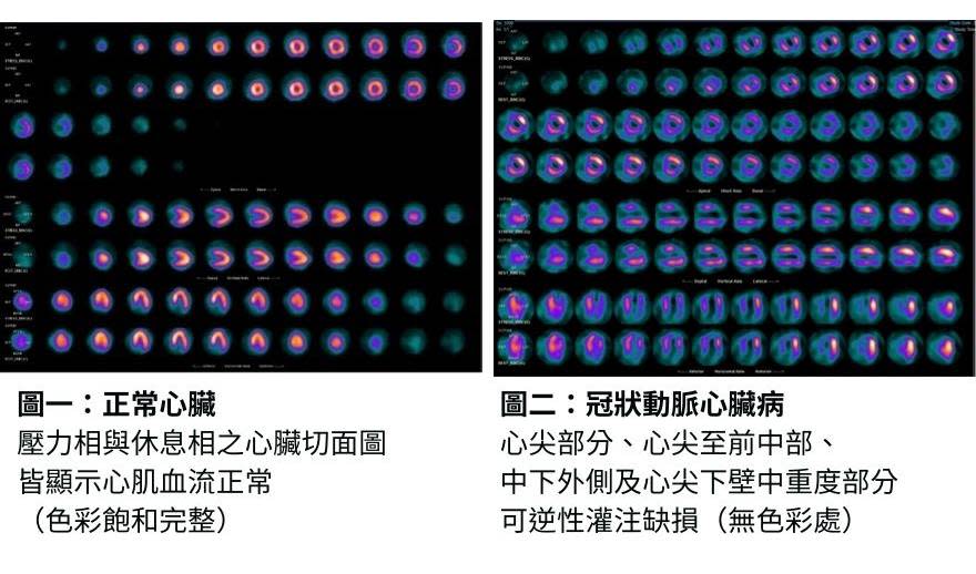 圖／張婉柔提供