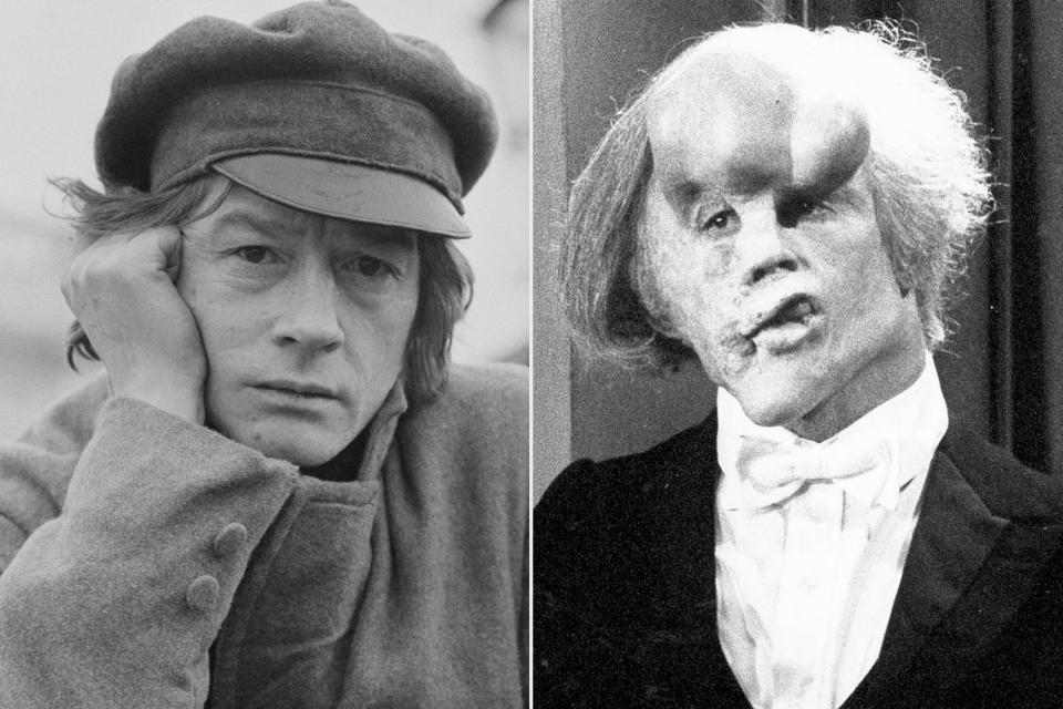 John Hurt, <i>The Elephant Man</i> (1980)John Hurt - <i>The Elephant Man</i> (1980)