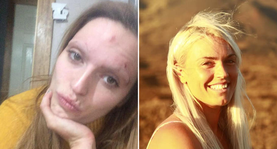 Ainsley Loudoun while on a binge drinking session (left) and now smiling and sober on a holiday (right)