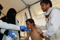 <p>Doctors treat a boy injured by an airstrike in Saada, Yemen, Aug. 9, 2018. (Photo: Naif Rahma/Reuters) </p>