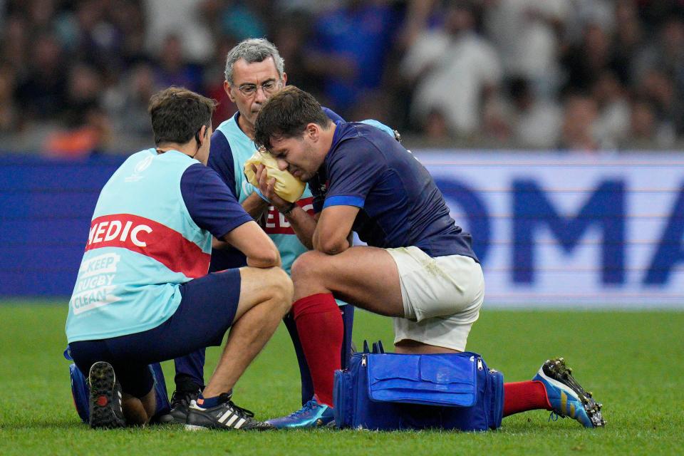 France’s Antoine Dupont receives treatment after taking a knock to the head (AP)
