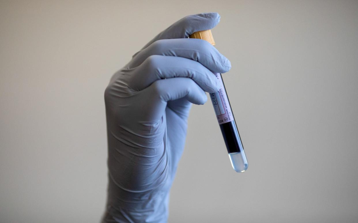 Hopes that the discovery will assist the development of a blood test that will be able to clinically diagnose depression - Reuters
