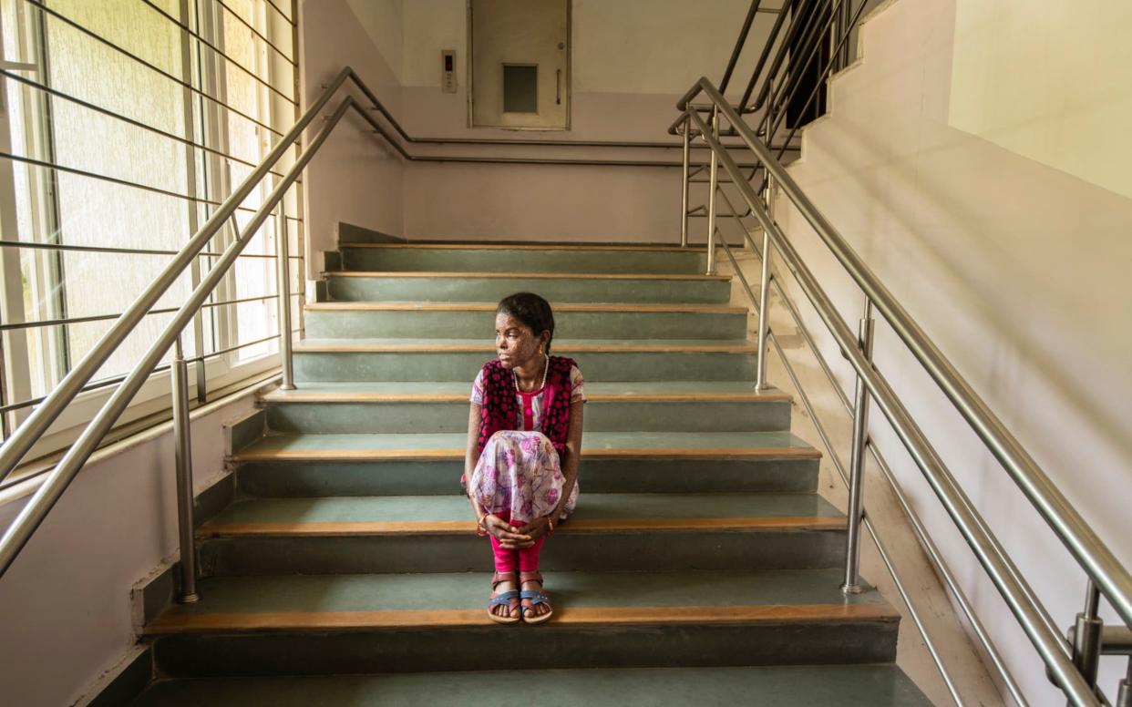 Sai Medha Bondagiri who has just received a cornea transplant at the Tej Kohli Cornea institute - © 2019 Simon Townsley Ltd