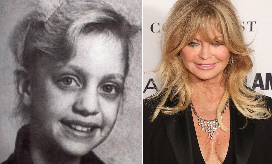 Goldie Hawn. Aquí vemos a una jovencísima Goldie Hawn y su aspecto después de las múltiples operaciones de estética. Fotos: Cdn.acidcow.com - Getty Images