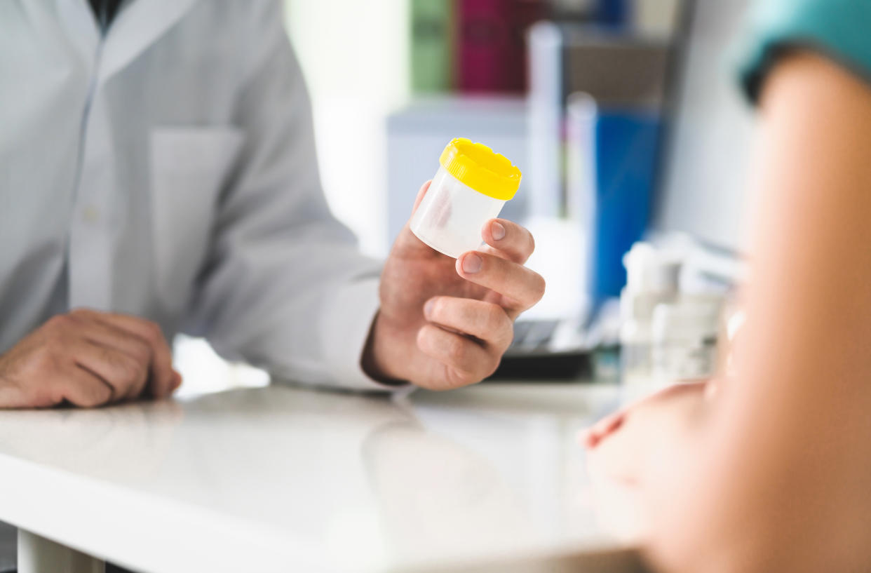 Doctor, patient and urine test cup. Physician giving pee container to a woman in clinic or hospital emergency room. Urinary sample for medical exam in hospital. Checkup for infection or salmonella.