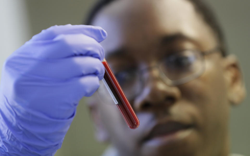 Leon McFarlane, a research technician, handles a blood sample in a laboratory at Imperial College in London, which is working on the development of a COVID-19 vaccine. (Photo: AP Photo/Kirsty Wigglesworth)