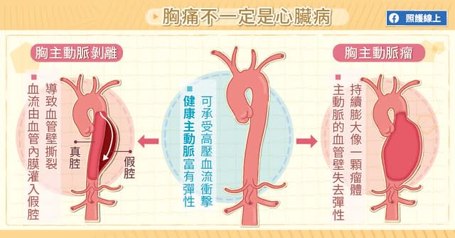 胸痛