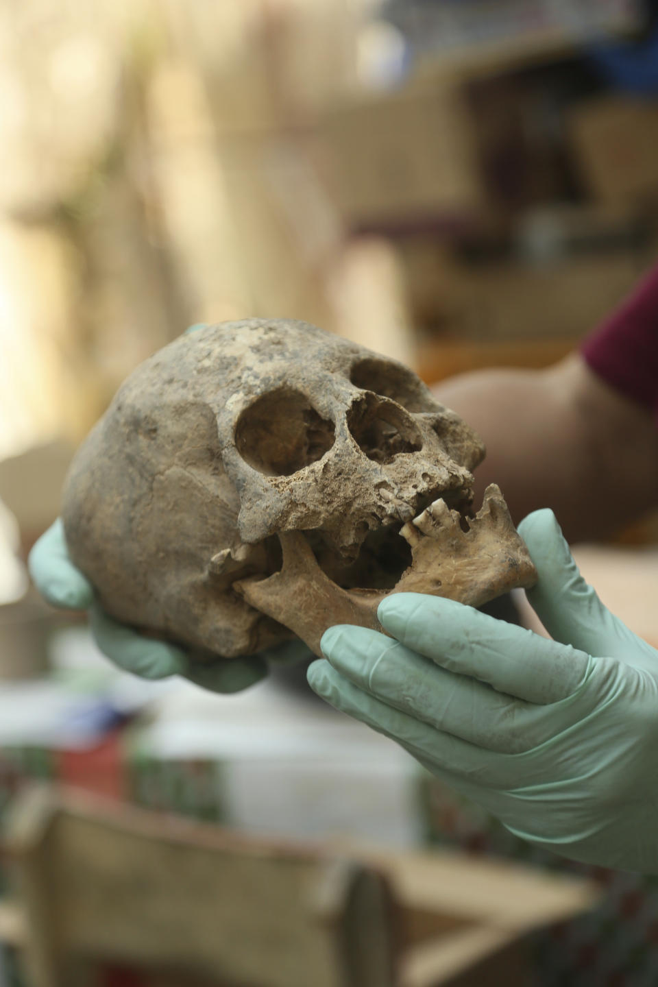 Jedu Sadarnaga shows an elongated skull on Thursday, Nov. 15, 2018 from one of the tombs found at a Bolivian quarry near the capital of La Paz. The tombs contained remains belonging to more than 100 individuals and were buried with more than 30 vessels used by the Incas. (AP Photo/Luis Gandarillas)