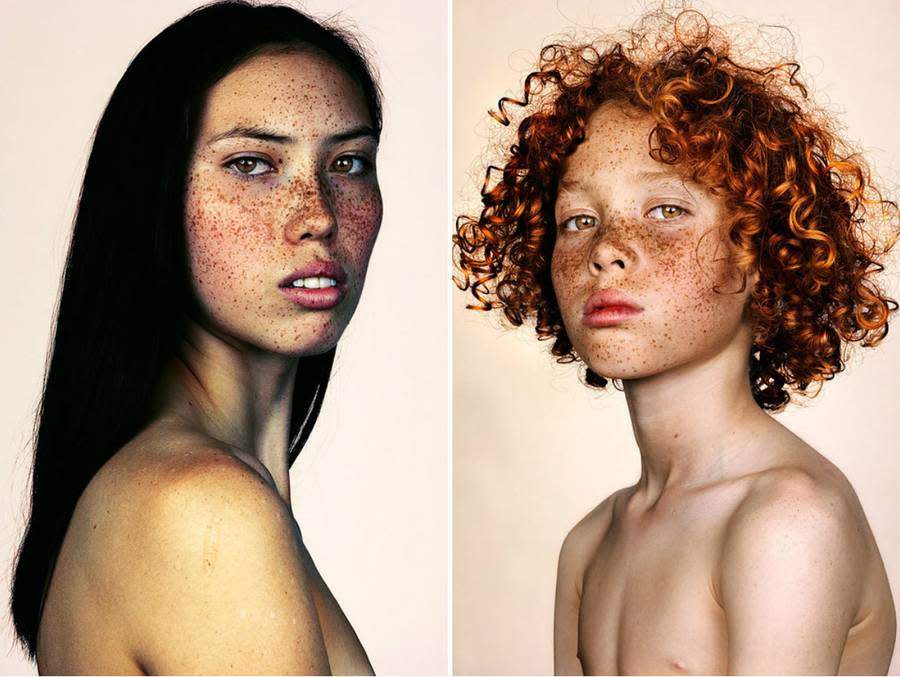 These Portraits Show How Beautifully Mesmerizing Freckles Can Be  