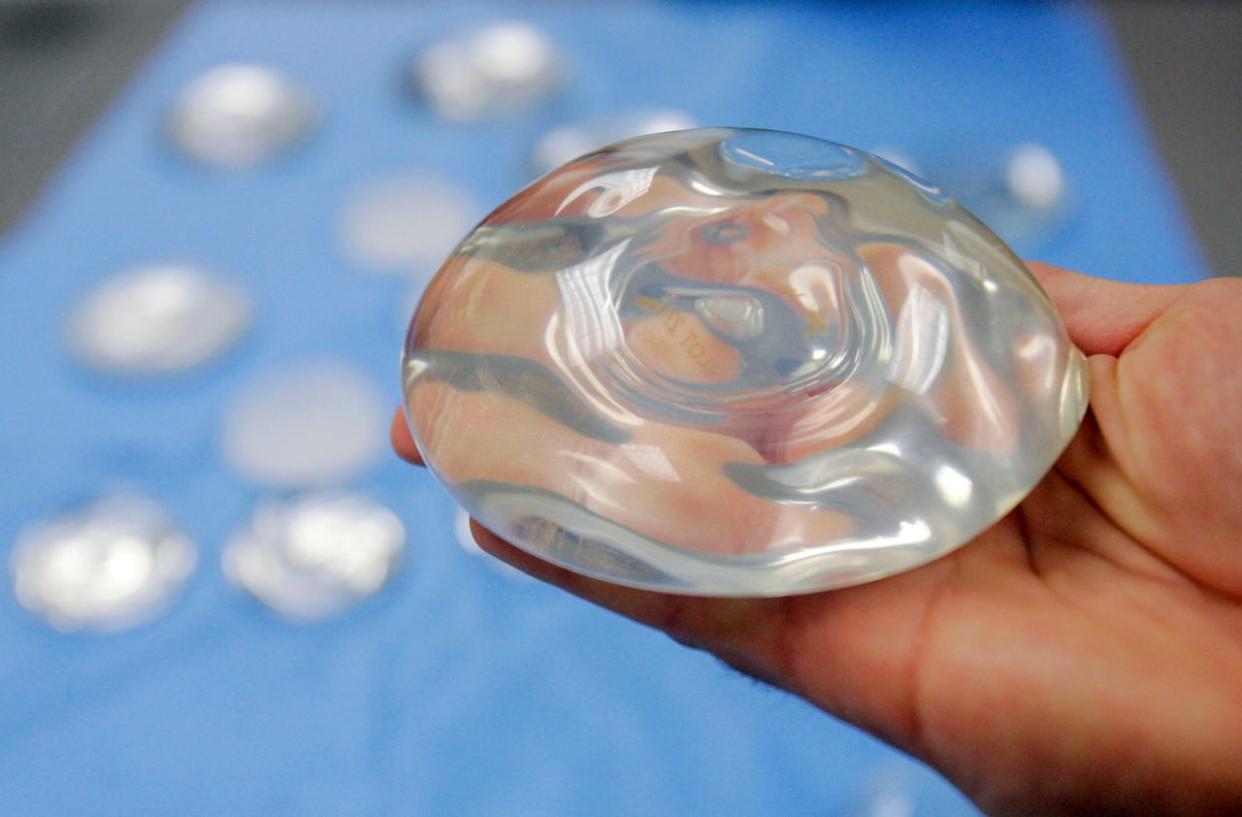 A silicone gel breast implant. Unlike many peer countries, Canada has no national medical device registry. (Donna McWilliam/The Associated Press - image credit)