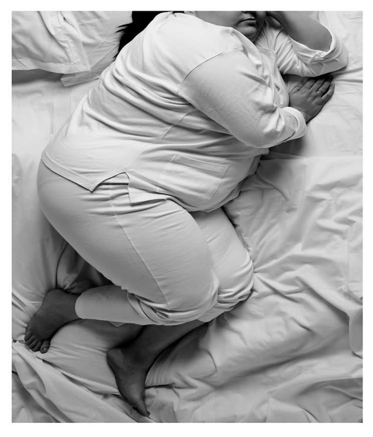 A woman in Egypt has spent most of her life bedridden due to her extreme weight. (Photo: Getty)