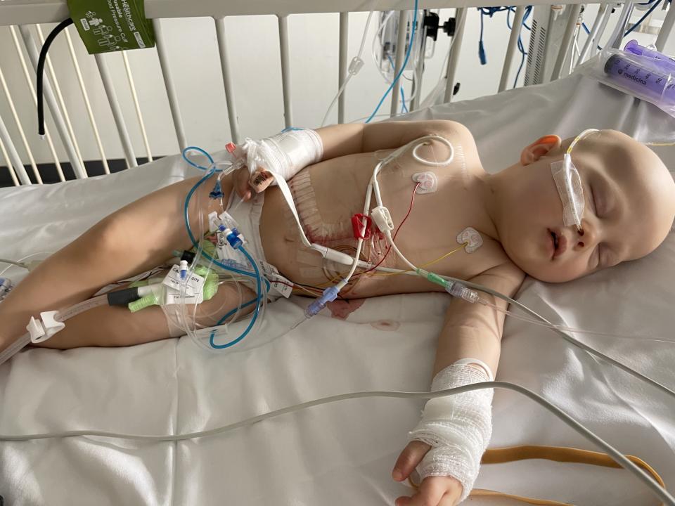 Jaxon pictured after receiving a life-saving liver resection at Leeds General Hospital. (Hayley Barnes/SWNS)