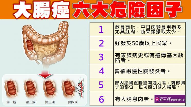 The six major risk factors for colorectal cancer