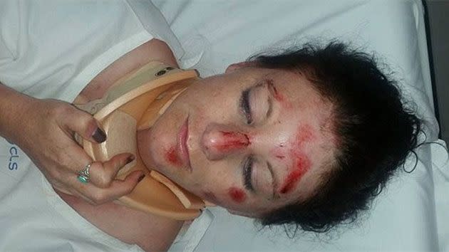 Police claim the Melbourne woman was aggressive and suffered minor injuries while resisting arrest. Photo: Facebook