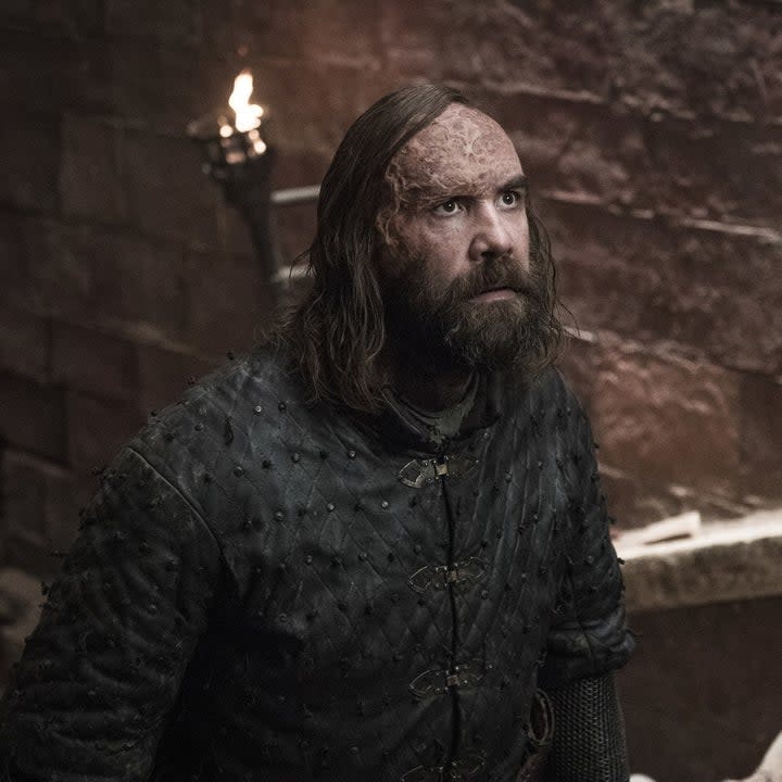 Rory McCann stands on the stairs