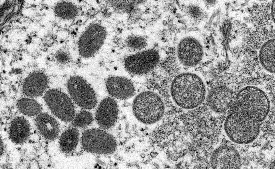 <span class="caption">Micrographie électronique de particules de virus de la variole du singe isolés en 2003 aux États-Unis, dans des échantillons humains (à gauche, les virus matures, ovales, à droite les virus immatures, ronds).</span> <span class="attribution"><a class="link " href="https://phil.cdc.gov/Details.aspx?pid=22664" rel="nofollow noopener" target="_blank" data-ylk="slk:Cynthia S. Goldsmith, Russell Regner / CDC / AP;elm:context_link;itc:0;sec:content-canvas">Cynthia S. Goldsmith, Russell Regner / CDC / AP</a></span>