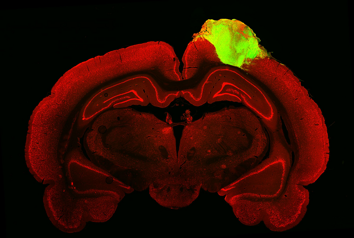 An image of a rat brain with a grafted human brain organoid (Cell) 