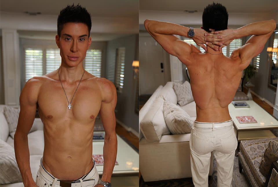 Plastic surgery consultant Justin Jedlica has spent a whopping $720,000 on 550 cosmetic procedures. Photo: Barcroft