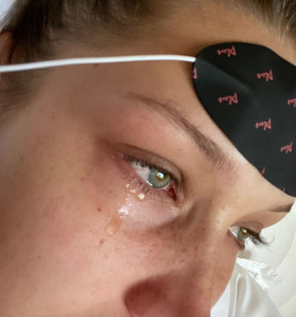 A tear runs down Bella's eye as she has a face mask on her forehead