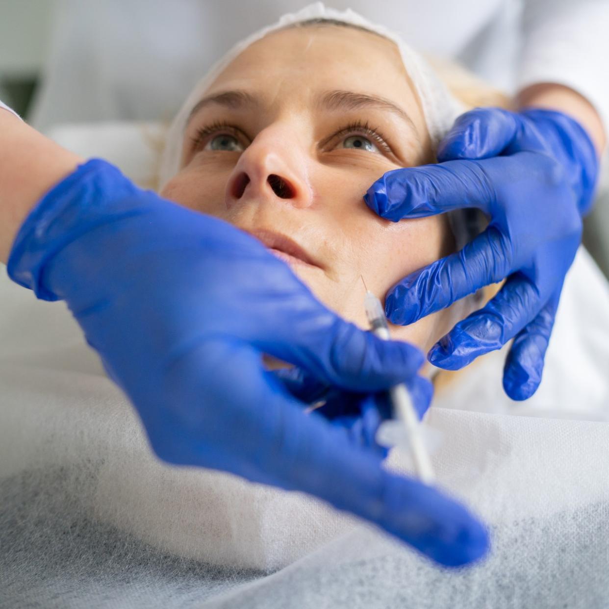  woman getting filler to treat acne scars  