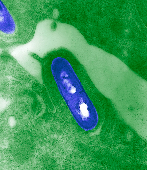 <em>Listeria can pose a particular threat to the elderly and pregnant women (Rex)</em>