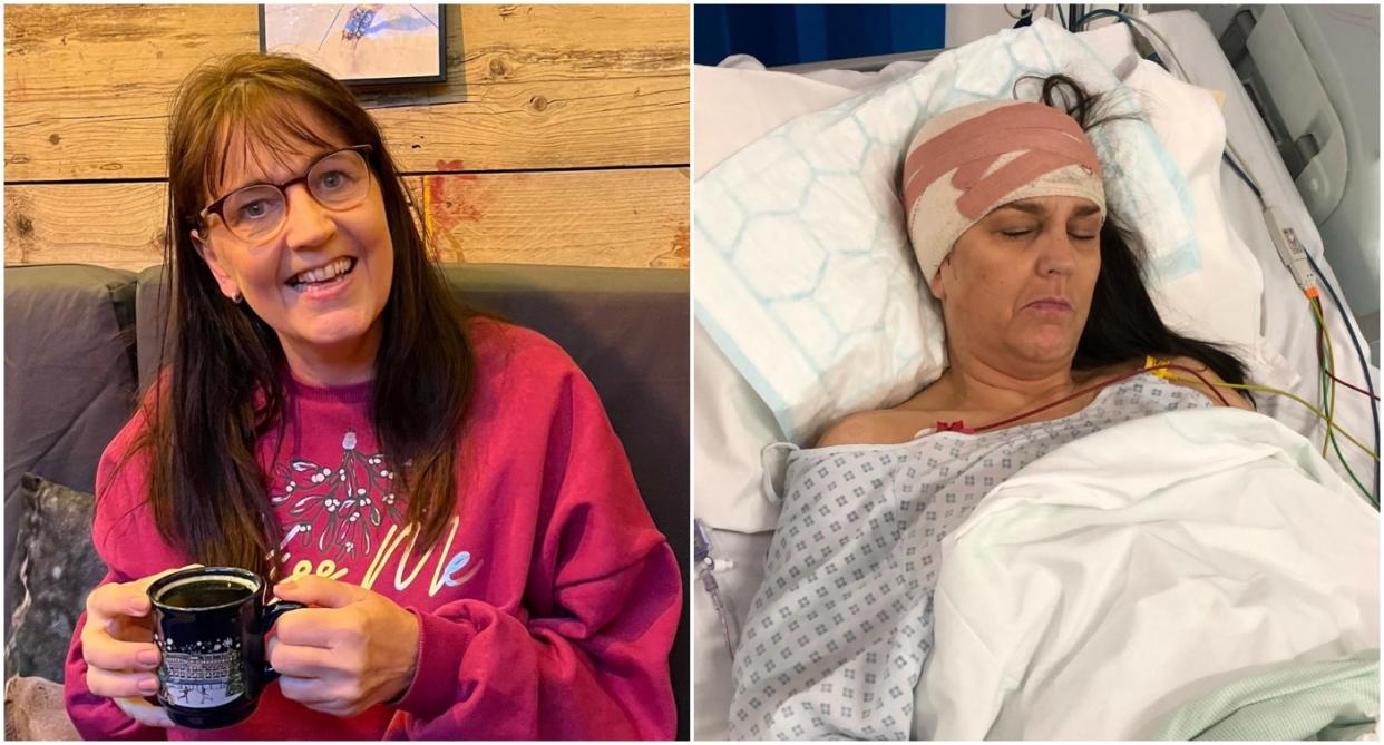 Doctors found a brain tumour after Denise Wingfield thought she had tinnitus. (SWNS)