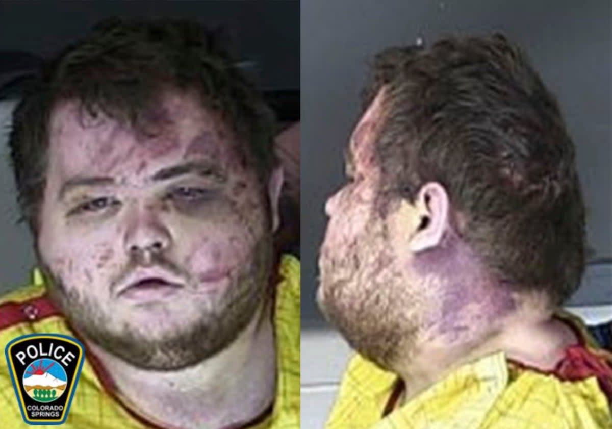 FILE - This booking photo provided by the Colorado Springs, Colo., Police Department shows Anderson Lee Aldrich. (Colorado Springs Police Department via AP, File) (Colorado Springs Police Department)
