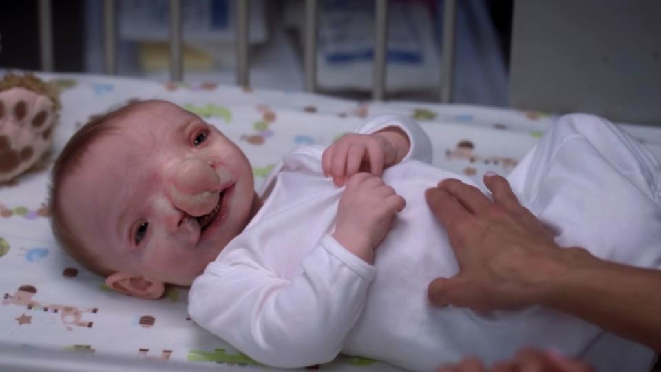 Baby Born With Brain Outside Of His Body (Season 9, Episodes 22-23)