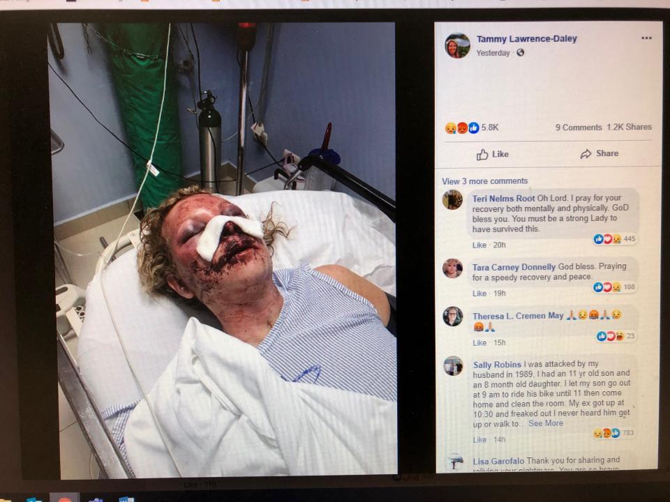 Tammy Lawrence-Daley shared this photo on Facebook as she recounted an attack that she says occurred while on a January vacation to the Dominican Republic.