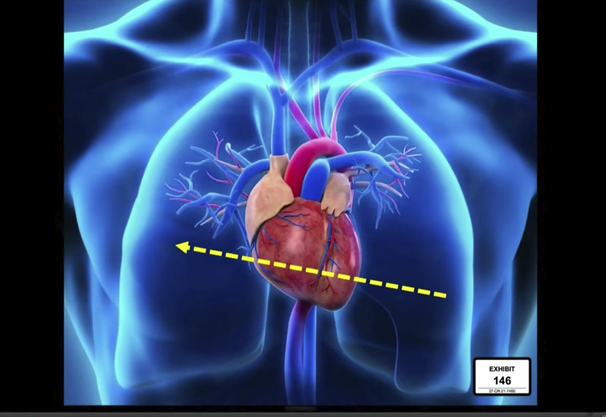 In this screen grab from video, an illustration of the path of the projectile recovered from Donte Wright's body is discussed by Dr. Lorren Jackson, assistant medical examiner at Hennepin County, while testifying as Hennepin County Judge Regina Chu presides over court Monday, Dec. 13, 2021, in the trial of former Brooklyn Center police Officer Kim Potter in the April 11, 2021, death of Daunte Wright, at the Hennepin County Courthouse in Minneapolis, Minn. (Court TV via AP, Pool)