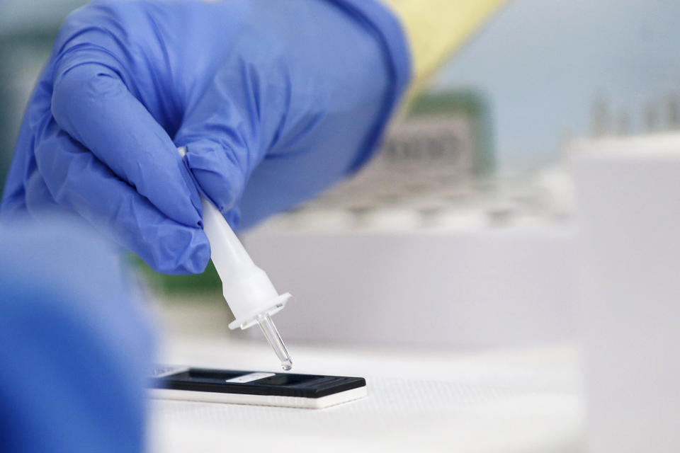 Medical staff holds swabs for rapid COVID-19 tests at a high school in Rome, Monday, Sept. 28, 2020. While hospitalizations and intensive care admissions are slightly rising, Italy has so far managed to keep its coronavirus infections per 100,000 people far lower than France, Spain or Britain, which earlier this week were forced to impose new restrictions to avoid a second pandemic wave. (Cecilia Fabiano/LaPresse via AP)