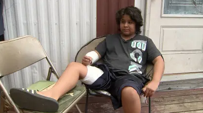 Dominic Morales was bitten by a dog that also seriously injured a 9-year-old girl.