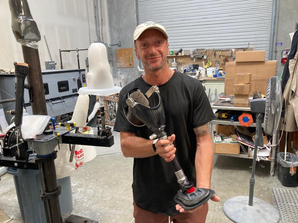 Fabrizio Passetti displays his new prosthetic leg at Channel Islands Prosthetics-Orthotics in Ventura on Nov. 2 before heading to a surf competition in Huntington Beach.