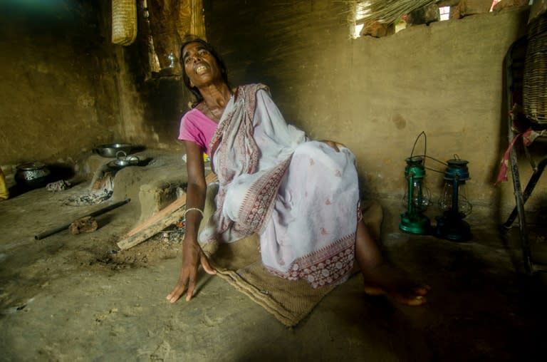 Surseri Mandal, 72, was accused of practicing witchcraft after residents of Dumra claimed she was responsible for the death of a cow in the village, in Jharkhand state in August 2015