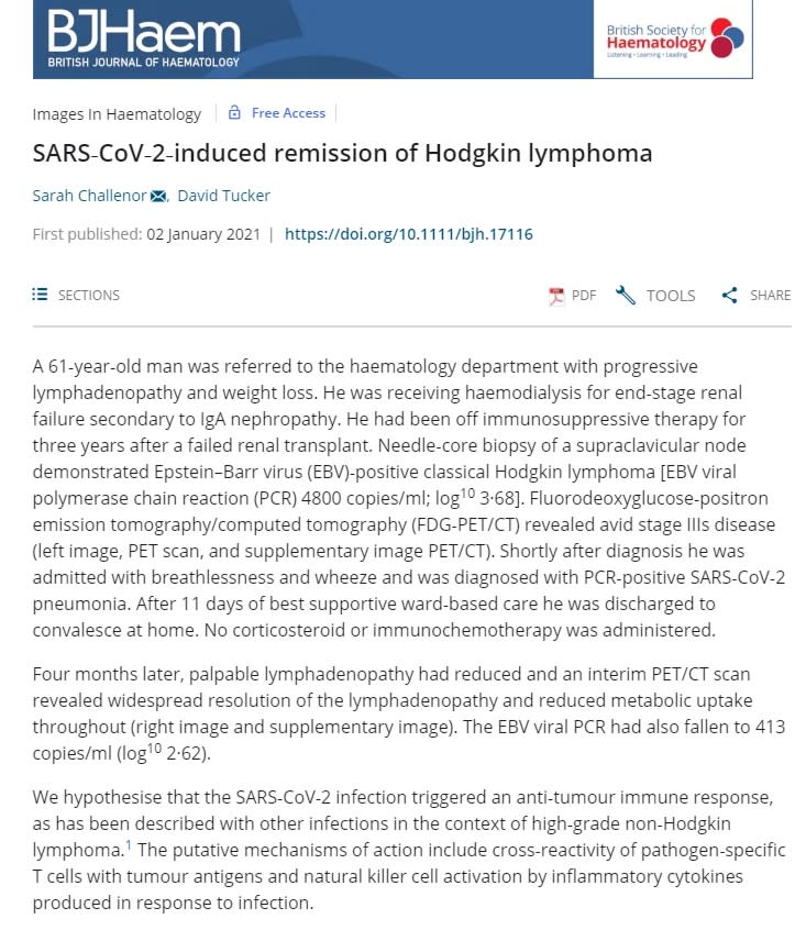 惡性淋巴瘤患者在感染新冠病毒後，體內的腫瘤竟然自己消失了。（圖／翻攝自SARS‐CoV‐2‐induced remission of Hodgkin lymphoma）