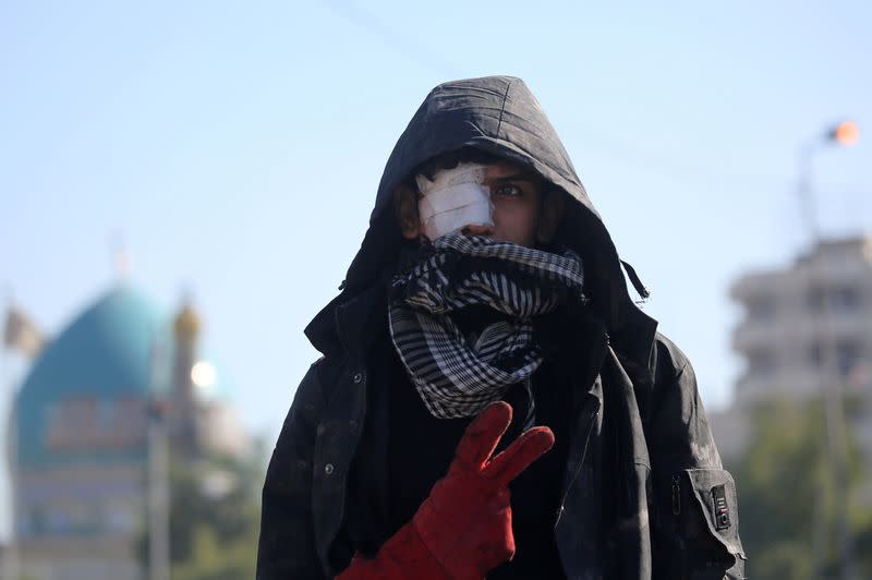 An Injured Iraqi demonstrator flashes the victory sign during ongoing anti-government protests in Baghdad