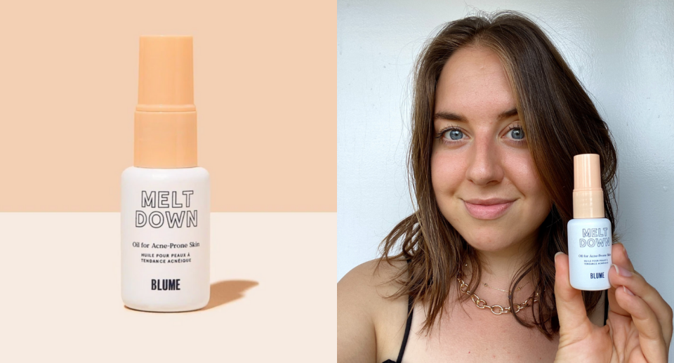 I put Blume's Meltdown Acne Oil to the test — here's my honest review (Photos via Blume & Kayla Kuefler)