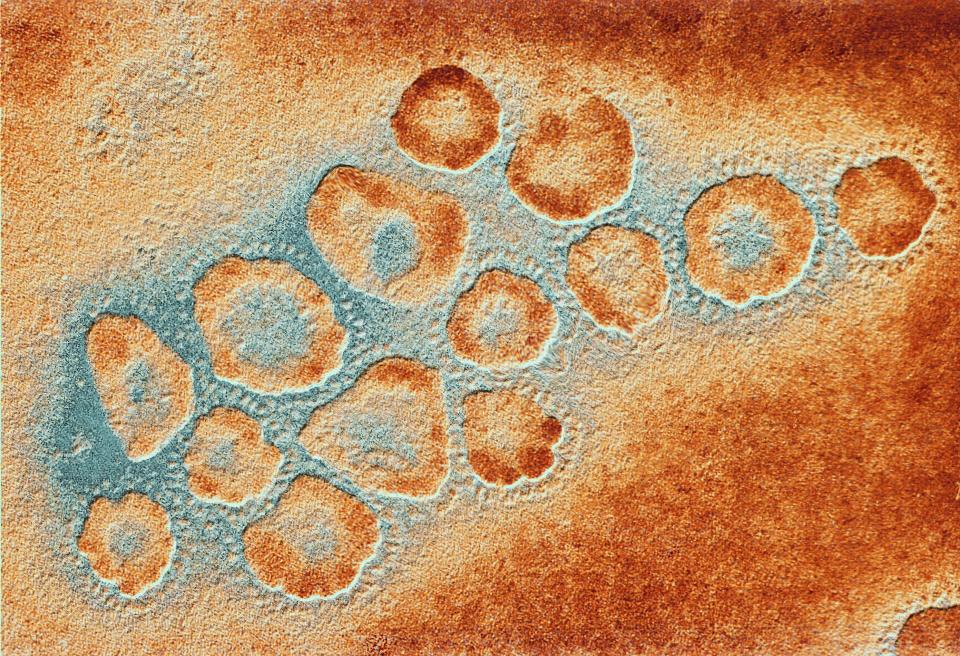 close up picture of influenza virus orange and blue