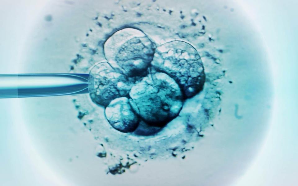 Embryo selection for in vitro fertilisation. The US have created a sperm selection technique that could bypass current laws - Science Photo Library - ZEPHYR/Brand x