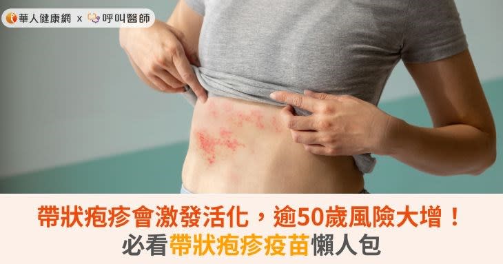 帶狀疱疹會激發活化，逾50歲風險大增！必看帶狀疱疹疫苗懶人包