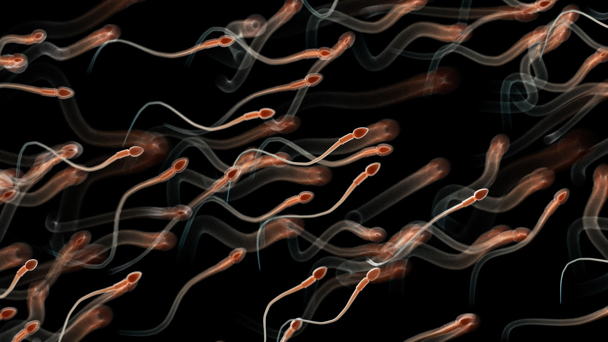  An illustration of many human sperm cells swimming from the lower left to upper right corner against a black background. 