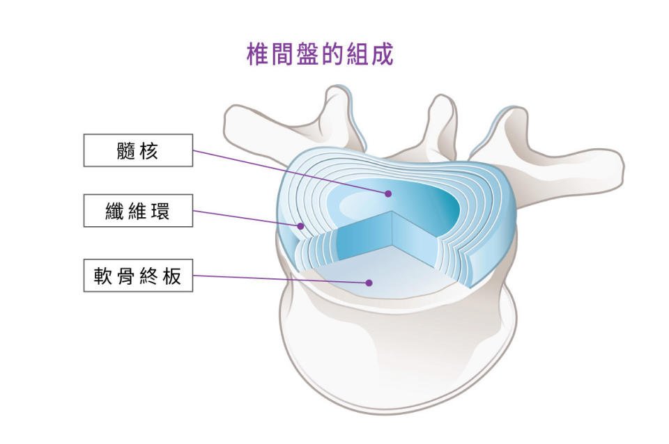 椎間盤由髓核、纖維環及軟骨終板等部份組成。（圖／菁英診所提供）