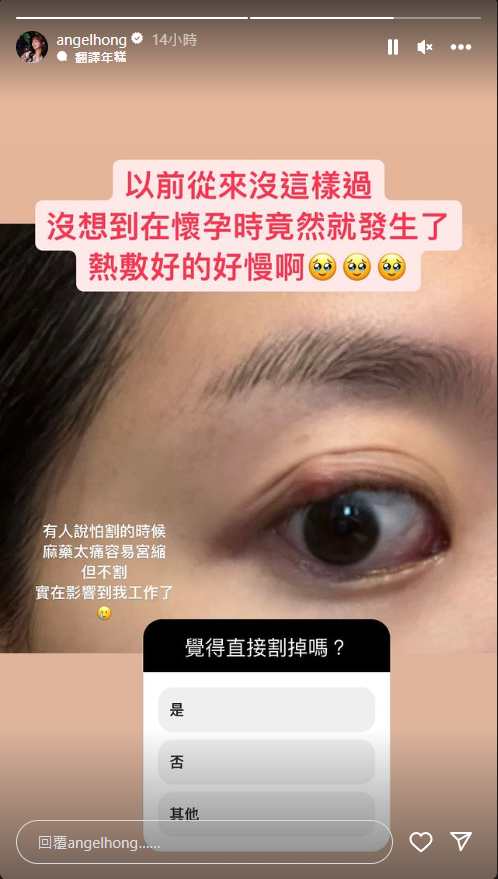 <strong>洪詩詢問是否要割除針眼。（圖／翻攝自洪詩 IG）</strong>