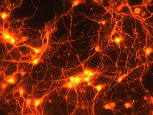 <span class="caption">Connections between brain cells.</span> <span class="attribution"><a class="link " href="https://www.flickr.com/photos/132318516@N08/22798807131" rel="nofollow noopener" target="_blank" data-ylk="slk:NIH Image Gallery/Flickr;elm:context_link;itc:0;sec:content-canvas">NIH Image Gallery/Flickr</a>, <a class="link " href="http://creativecommons.org/licenses/by-nc/4.0/" rel="nofollow noopener" target="_blank" data-ylk="slk:CC BY-NC;elm:context_link;itc:0;sec:content-canvas">CC BY-NC</a></span>