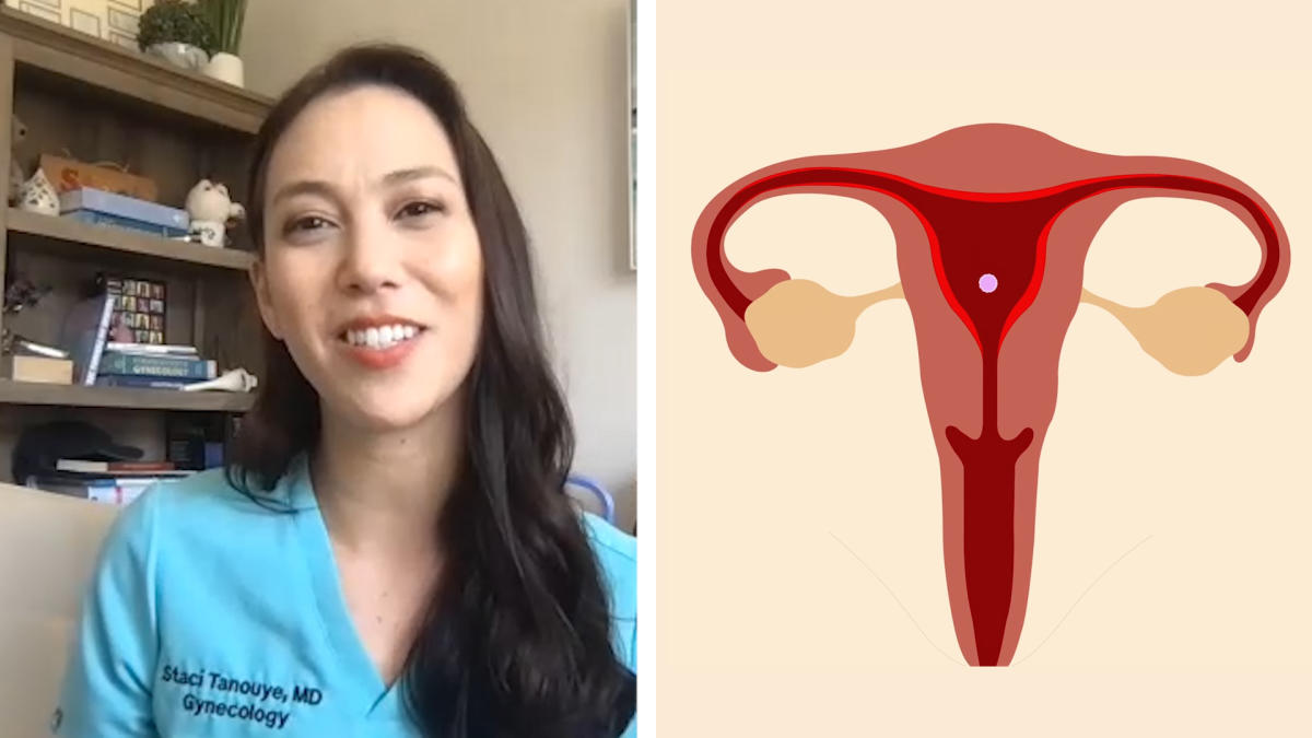 Ob Gyn Busts Common Myths About Periods