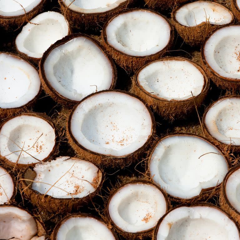 Get rid of a sunburn with coconut oil